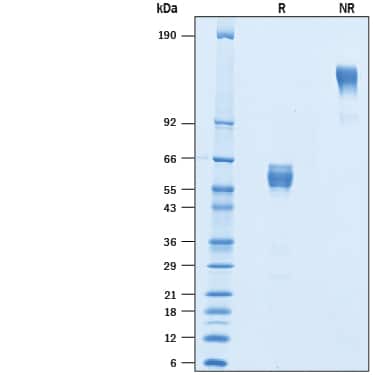 2 μg/lane of Recombinant Mouse CD300d Fc Chimera (Catalog # 10310-LM) was  resolved with SDS-PAGE under reducing (R) and non-reducing (NR)  conditions and visualized by Coomassie® Blue staining, showing bands at 48-66 kDa and 100-130 kDa, respectively.