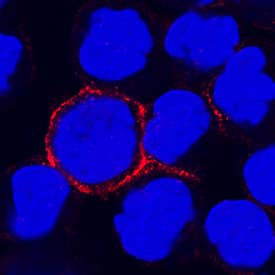 CD300f/LMIR3 was detected in immersion fixed human peripheral blood mononuclear cells (PBMCs) using Rat Anti-Human CD300f/LMIR3 Monoclonal Antibody (Catalog # MAB2774) at 15 µg/mL for 3 hours at room temperature. Cells were stained using the NorthernLights™ 557-conjugated Anti-Rat IgG Secondary Antibody (red; Catalog # NL013) and counterstained with DAPI (blue). Specific staining was localized to cell surfaces. View our protocol for Fluorescent ICC Staining of Non-adherent Cells.