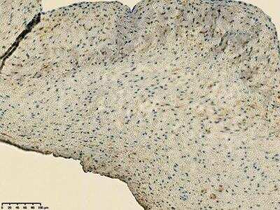 Immunohistochemistry-Paraffin: CD39/ENTPD1 Antibody [NBP1-90071] - Staining of pig aortic valve tissue. Image from verified customer review.
