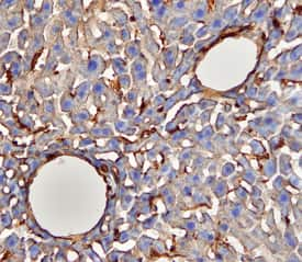 CD39/ENTPD1 was detected in perfusion fixed frozen sections of mouse liver using Mouse CD39/ENTPD1 Antigen Affinity-purified Polyclonal Antibody (Catalog # AF4398) at 15 µg/mL overnight at 4 °C. Tissue was stained using the Anti-Sheep HRP-DAB Cell & Tissue Staining Kit (brown; Catalog # CTS019) and counterstained with hematoxylin (blue). View our protocol for Chromogenic IHC Staining of Frozen Tissue Sections.