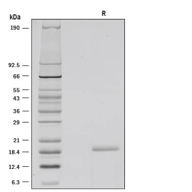 1 μg/lane of Recombinant Human CD40 Ligand/TNFSF5 (Histidine-tagged) was resolved with SDS-PAGE under reducing (R) conditions and visualized by silver staining, showing a single band at 19 kDa.