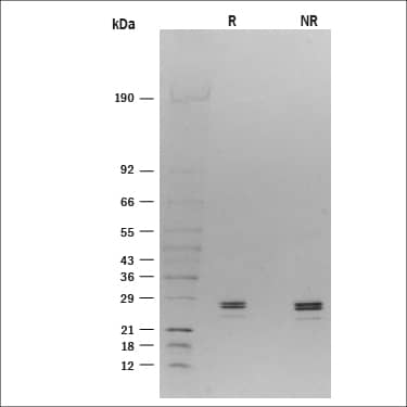 1 μg/lane of Recombinant Rat CD40 Ligand/TNFSF5 was resolved with SDS-PAGE under reducing (R) and non-reducing (NR) conditions and visualized by silver staining, showing R bands at 26, 28 kDa and NR bands at 26, 28 kDa.