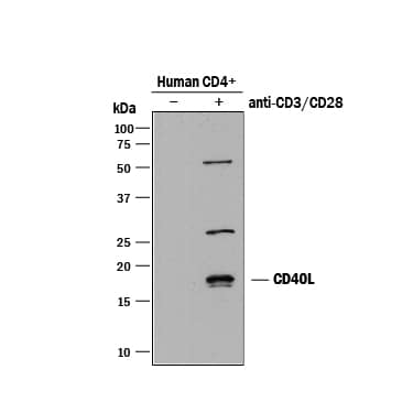 Western blot shows lysates of human CD4+cells untreated (-) or treated (+) with immobilized Mouse Anti-Human CD3e Monoclonal Antibody (Catalog # MAB100) and Mouse Anti-Human CD28 Monoclonal Antibody (Catalog # MAB342). PVDF membrane was probed with 1 µg/mL of Mouse Anti-Human CD40 Ligand/TNFSF5 Monoclonal Antibody (Catalog # MAB6171) followed by HRP-conjugated Anti-Mouse IgG Secondary Antibody (Catalog # HAF018). Specific bands were detected for CD40 Ligand/TNFSF5 at approximately 15-18 kDa (as indicated). This experiment was conducted under reducing conditions and using Immunoblot Buffer Group 1.