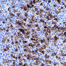     CD45  was detected in immersion fixed paraffin-embedded sections of human tonsil  using Mouse Anti-Human CD45 Monoclonal Antibody (Catalog # MAB14302) at  15 µg/mL for 1 hour at room temperature followed by  incubation with the Anti-Mouse IgG VisUCyte™ HRP Polymer Antibody  (Catalog # VC001).  Before incubation with the primary antibody, tissue was subjected to heat-induced  epitope retrieval using Antigen Retrieval Reagent-Basic (Catalog # CTS013).  Tissue was stained using DAB (brown) and counterstained with hematoxylin  (blue). Specific staining was localized to cytoplasm in lymphocytes. View our  protocol for IHC  Staining with VisUCyte HRP Polymer Detection Reagents. 