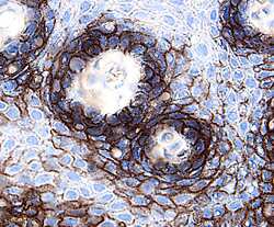 CD58/LFA‑3 was detected in immersion fixed paraffin-embedded sections of human tonsil using 15 µg/mL Goat Anti-Human CD58/LFA‑3 Antigen Affinity-purified Polyclonal Antibody (Catalog # AF1689) overnight at 4 °C. Tissue was stained with the Anti-Goat HRP-DAB Cell & Tissue Staining Kit (brown; Catalog # CTS008) and counterstained with hematoxylin (blue). Specific labeling was localized to the plasma membrane of lymphocytes in lymphatic nodules. View our protocol for Chromogenic IHC Staining of Paraffin-embedded Tissue Sections.