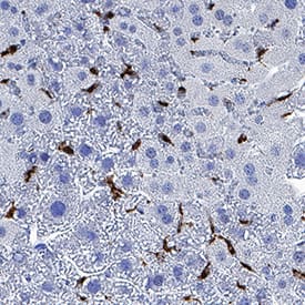 CD68/SR-D1 was detected in immersion fixed paraffin-embedded sections of mouse liver using Rabbit Anti-Mouse CD68/SR-D1 Monoclonal Antibody (Catalog # MAB101141) at 3 µg/mL for 1 hour at room temperature followed by incubation with the Anti-Rabbit IgG VisUCyte™ HRP Polymer Antibody (Catalog # VC003). Before incubation with the primary antibody, tissue was subjected to heat-induced epitope retrieval using Antigen Retrieval Reagent-Basic (Catalog # CTS013). Tissue was stained using DAB (brown) and counterstained with hematoxylin (blue). Specific staining was localized to Kupffer cells. View our protocol for IHC Staining with VisUCyte HRP Polymer Detection Reagents.