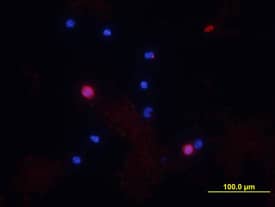 CD8a was detected in immersion fixed feline peripheral blood mononuclear cells (PBMCs) using Goat Anti-Feline CD8a Antigen Affinity-purified Polyclonal Antibody (Catalog # AF2598) at 10 µg/mL for 3 hours at room temperature. Cells were stained using the NorthernLights™ 557-conjugated Anti-Goat IgG Secondary Antibody (red; Catalog # NL001) and counterstained with DAPI (blue). View our protocol for Fluorescent ICC Staining of Non-adherent Cells.