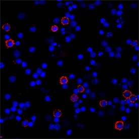 CD8a was detected in live human peripheral blood mononuclear cells (PBMCs) using Mouse Anti-Human CD8a Monoclonal Antibody (Catalog # MAB1509R) at 25 µg/mL for 3 hours at room temperature. Cells were stained using the NorthernLights™ 557-conjugated Anti-Mouse IgG Secondary Antibody (red; Catalog # NL007) and counterstained with DAPI (blue). Specific staining was localized to cell surface. View our protocol for Fluorescent ICC Staining of Non-adherent Cells.