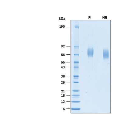 2 µg/lane of Recombinant Human CD97His-tag (Catalog # 10134-CD) was resolved with SDS-PAGE under reducing (R) andnon-reducing (NR) conditions and visualized by Coomassie® Blue staining,showing bands at 60-90 kDa.