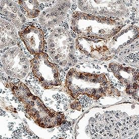     CD9  was detected in immersion fixed paraffin-embedded sections of human kidney  tissue using Mouse Anti-Human CD9 Monoclonal Antibody (Catalog # MAB25292) at  5 µg/mL for 1 hour at room temperature followed by  incubation with the Anti-Mouse IgG VisUCyte™ HRP Polymer Antibody  (Catalog # VC001).  Before incubation with the primary antibody, tissue was subjected to heat-induced  epitope retrieval using Antigen Retrieval Reagent-Basic (Catalog # CTS013).  Tissue was stained using DAB (brown) and counterstained with hematoxylin  (blue). Specific staining was localized to cell membrane in convoluted  tubules. View our protocol for IHC  Staining with VisUCyte HRP Polymer Detection Reagents. 