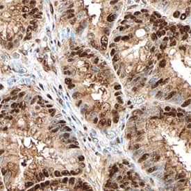 CDK8 was detected in immersion fixed paraffin-embedded sections of human colon using Sheep Anti-Human CDK8 Antigen Affinity-purified Polyclonal Antibody (Catalog # AF6809) at 15 µg/mL overnight at 4 °C. Before incubation with the primary antibody, tissue was subjected to heat-induced epitope retrieval using Antigen Retrieval Reagent-Basic (Catalog # CTS013). Tissue was stained using the Anti-Sheep HRP-DAB Cell & Tissue Staining Kit (brown; Catalog # CTS019) and counterstained with hematoxylin (blue). Specific staining was localized to nuclei of epithelial cells. View our protocol for Chromogenic IHC Staining of Paraffin-embedded Tissue Sections.