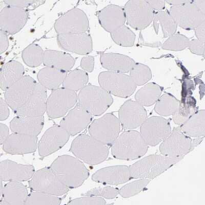 Immunohistochemistry-Paraffin: CDKL5 Antibody [NBP1-84881] - Staining of human skeletal muscle shows no positivity in myocytes as expected.