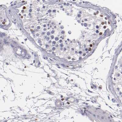 Immunohistochemistry-Paraffin: CDKL5 Antibody [NBP1-84881] - Staining of human testis shows moderate nuclear positivity in cells.
