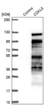 Western Blot: CDKL5 Antibody [NBP1-84881] - Analysis in control (vector only transfected HEK293T lysate) and CDKL5 over-expression lysate (Co-expressed with a C-terminal myc-DDK tag (3.1 kDa) in mammalian HEK293T cells).