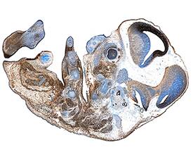 CDO was detected in immersion fixed frozen sections of mouse embryo (13 d.p.c.) using Goat Anti-Mouse CDO Biotinylated Antigen Affinity-purified Polyclonal Antibody (Catalog # BAF2429) at 1.7 µg/mL overnight at 4 °C. Tissue was stained using the Anti-Goat HRP-DAB Cell & Tissue Staining Kit (brown; Catalog # CTS008) and counterstained with hematoxylin (blue). Specific staining was localized to developing central nervous system, cartilage and muscle cells. View our protocol for Chromogenic IHC Staining of Frozen Tissue Sections.
