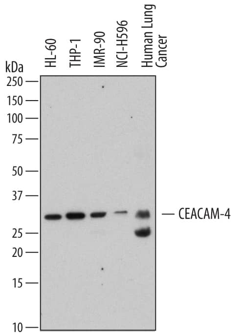 Western blot shows lysates of HL-60 human acute promyelocytic leukemia cell line, THP-1 human acute monocytic leukemia cell line, IMR-90 human lung fibroblast cell line, NCI-H596 human lung adenosquamous carcinoma cell line, and human lung cancer tissue. PVDF membrane was probed with 2 µg/mL of Mouse Anti-Human CEACAM-4 Monoclonal Antibody (Catalog # MAB4354) followed by HRP-conjugated Anti-Mouse IgG Secondary Antibody (Catalog # HAF007). A specific band was detected for CEACAM-4 at approximately 30 kDa (as indicated). This experiment was conducted under reducing conditions and using Immunoblot Buffer Group 1.