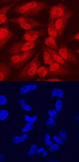 CEBP e was detected in immersion fixed HeLa human cervical epithelial carcinoma cell line using Mouse Anti-Human CEBP e Monoclonal Antibody (Catalog # MAB6726) at 10 µg/mL for 3 hours at room temperature. Cells were stained using the NorthernLights™ 557-conjugated Anti-Mouse IgG Secondary Antibody (red, upper panel; Catalog # NL007) and counterstained with DAPI (blue, lower panel). Specific staining was localized to nuclei. View our protocol for Fluorescent ICC Staining of Cells on Coverslips.