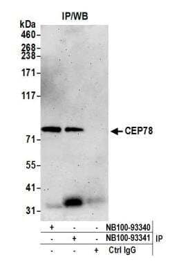 CEP78 Antibody (NB100-93341): Novus Biologicals