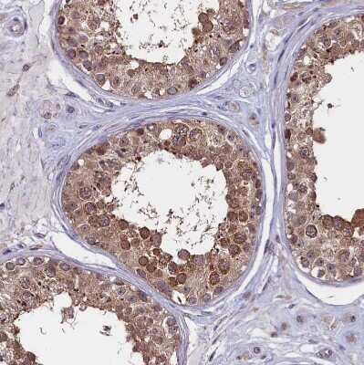 Immunohistochemistry-Paraffin CIAPIN1 Antibody