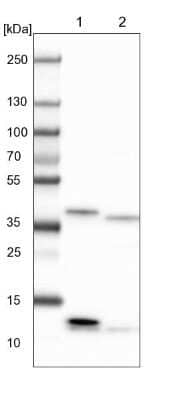 Western Blot CIAPIN1 Antibody