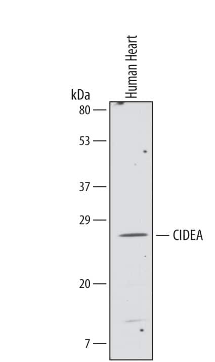 Western Blot CIDEA Antibody