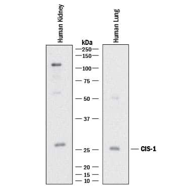 Western blot shows lysates of human lung tissue and human kidney tissue. PVDF membrane was probed with 2 µg/mL of Rat Anti-Human CIS-1 Monoclonal Antibody (Catalog # MAB3194) followed by HRP-conjugated Anti-Rat IgG Secondary Antibody (Catalog # HAF005). A specific band was detected for CIS-1 at approximately 28 kDa (as indicated). This experiment was conducted under reducing conditions and using Immunoblot Buffer Group 1.