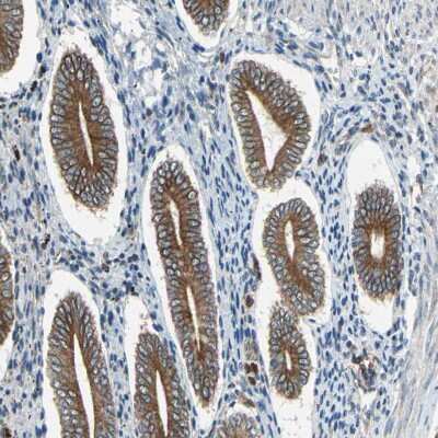 SARS-CoV-2 ORF3A interacts with the Clic-like chloride channel-1 (CLCC1)  and triggers an unfolded protein response [PeerJ]