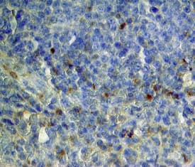 CLEC9a was detected in immersion fixed paraffin-embedded sections of human spleen using Sheep Anti-Human CLEC9a Antigen Affinity-purified Polyclonal Antibody (Catalog # AF6049) at 15 µg/mL overnight at 4 °C. Tissue was stained using the Anti-Sheep HRP-DAB Cell & Tissue Staining Kit (brown; Catalog # CTS019) and counterstained with hematoxylin (blue). Specific staining was localized to cytoplasm. View our protocol for Chromogenic IHC Staining of Paraffin-embedded Tissue Sections.