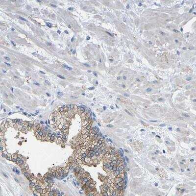 CMTM1 Antibody (NBP1-84459): Novus Biologicals