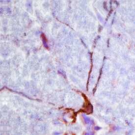 CNTF was detected in perfusion fixed frozen sections of rat brain (midbrain) using Goat Anti-Rat CNTF Biotinylated Antigen Affinity-purified Polyclonal Antibody (Catalog # BAF557) at 1.7 µg/mL overnight at 4 °C. Tissue was stained using the Anti-Goat HRP-DAB Cell & Tissue Staining Kit (brown; Catalog # CTS008) and counterstained with hematoxylin (blue). Specific staining was localized to cell bodies and neuronal processes. View our protocol for Chromogenic IHC Staining of Frozen Tissue Sections.