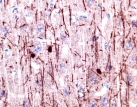 CNTF Ra was detected in perfusion fixed frozen sections of rat brain using 5 µg/mL Goat Anti-Rat CNTF Ra Biotinylated Antigen Affinity-purified Polyclonal Antibody (Catalog # BAF559) overnight at 4 °C. Before incubation with the primary antibody tissue was subjected to heat-induced epitope retrieval using Antigen Retrieval Reagent-Basic (Catalog # CTS013). Tissue was stained with the Anti-Goat HRP-AEC Cell & Tissue Staining Kit (red; Catalog # CTS009) and counterstained with hematoxylin (blue). View our protocol for Chromogenic IHC Staining of Frozen Tissue Sections.