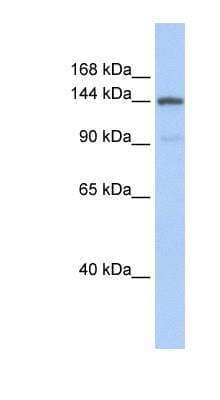 Western Blot: COL1A2 Antibody [NBP1-57987] - Human Liver cell lysate, concentration 0.2-1 ug/ml.
