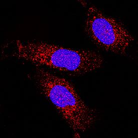 COMMD1 was detected in immersion fixed U2OS human osteosarcoma cell line using Mouse Anti-Human COMMD1 Monoclonal Antibody (Catalog # MAB7526) at 8 µg/mL for 3 hours at room temperature. Cells were stained using the NorthernLights™ 557-conjugated Anti-Mouse IgG Secondary Antibody (red; Catalog # NL007) and counterstained with DAPI (blue). Specific staining was localized to cytoplasm and nuclei. View our protocol for Fluorescent ICC Staining of Cells on Coverslips.