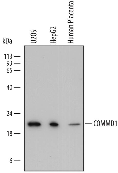 Western blot shows lysates of U2OS human osteosarcoma cell line, HepG2 human hepatocellular carcinoma cell line, and human placenta tissue. PVDF membrane was probed with 0.2 µg/mL of Mouse Anti-Human COMMD1 Monoclonal Antibody (Catalog # MAB7526) followed by HRP-conjugated Anti-Mouse IgG Secondary Antibody (Catalog # HAF018). A specific band was detected for COMMD1 at approximately 20 kDa (as indicated). This experiment was conducted under reducing conditions and using Immunoblot Buffer Group 1.