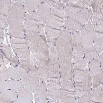 CRACC/SLAMF7 Antibody (NBP2-37951): Novus Biologicals