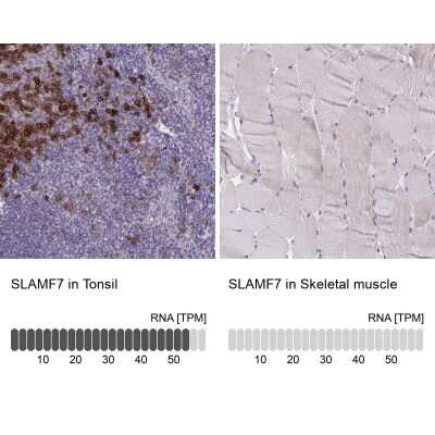 Immunohistochemistry-Paraffin: CRACC/SLAMF7 Antibody [NBP2-37951] - Staining in human tonsil and skeletal muscle tissues using anti-SLAMF7 antibody. Corresponding SLAMF7 RNA-seq data are presented for the same tissues.