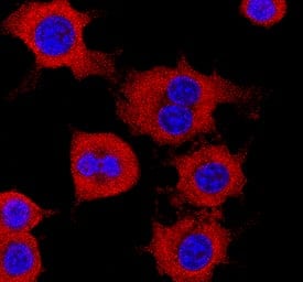 CRBN was detected in immersion fixed RAW 264.7 mouse monocyte/macrophage cell line using Mouse Anti-Human CRBN Polyclonal Antibody (Catalog # MAB9574) at 1 µg/mL for 3 hours at room temperature. Cells were stained using the NorthernLights™ 557-conjugated Anti-Mouse IgG Secondary Antibody (red; Catalog # NL007) and counterstained with DAPI (blue). Specific staining was localized to cytoplasm. View our protocol for Fluorescent ICC Staining of Non-adherent Cells.