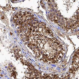     CRBN  was detected in immersion fixed paraffin-embedded sections of human testis  using Mouse Anti-Human CRBN Polyclonal Antibody (Catalog # MAB9574) at  5 µg/mL for 1 hour at room temperature followed by  incubation with the Anti-Mouse IgG VisUCyte™  HRP Polymer Antibody (Catalog #  VC001).  Tissue was stained using DAB (brown) and counterstained with hematoxylin  (blue).  Specific staining was  localized to cytoplasm. View our protocol for IHC  Staining with VisUCyte HRP Polymer Detection Reagents. 