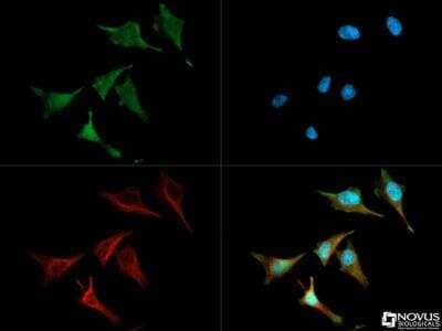 Immunocytochemistry/Immunofluorescence: CRIPTO Antibody [NB100-1597] -  Antibody was tested in HeLa cells with Dylight 488 (green). Nuclei were counterstained with DAPI (blue) and tubulin was stained with alpha tubulin (red).