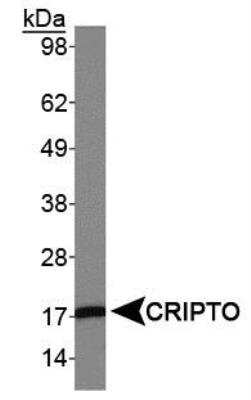 Western Blot: CRIPTO Antibody [NB100-1597] -  Analysis of Cripto in MDA-MB231 lysates.