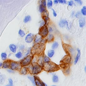 CRISP-3 was detected in immersion fixed paraffin-embedded sections of human prostate using Mouse Anti-Human CRISP-3 Monoclonal Antibody (Catalog # MAB23971) at 15 µg/mL overnight at 4 °C. Before incubation with the primary antibody tissue was subjected to heat-induced epitope retrieval using Antigen Retrieval Reagent-Basic (Catalog # CTS013). Tissue was stained using the Anti-Mouse HRP-DAB Cell & Tissue Staining Kit (brown; Catalog # CTS002) and counterstained with hematoxylin (blue). View our protocol for Chromogenic IHC Staining of Paraffin-embedded Tissue Sections.