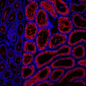 CRISP‑1 was detected in immersion fixed frozen sections of mouse epididymus using Goat Anti-Mouse CRISP‑1 Antigen Affinity-purified Polyclonal Antibody (Catalog # AF4675) at 10 µg/mL overnight at 4 °C. Tissue was stained using the NorthernLights™ 557-conjugated Anti-Goat IgG Secondary Antibody (red; Catalog # NL001) and counterstained with DAPI (blue). Specific staining was localized to cytoplasm. View our protocol for Fluorescent IHC Staining of Frozen Tissue Sections. 