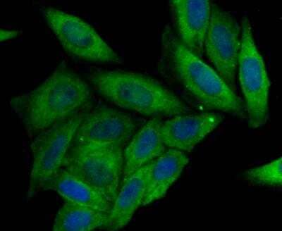 Immunocytochemistry/Immunofluorescence: CRMP2 Antibody [NBP2-89138] - Staining CRMP2 in SiHa cells (green). The nuclear counter stain is DAPI (blue). Cells were fixed in paraformaldehyde, permeabilised with 0.25% Triton X100/PBS.