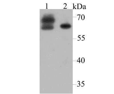 Western Blot: CRMP2 Antibody [NBP2-89138] - Analysis of CRMP2 on different lysates using anti-CRMP2 antibody at 1/5,000 dilution. Positive control: Lane 1: Mouse brain tissue Lane 2: SH-SY-5Y