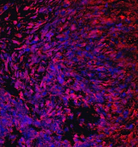 CRTAC1 was detected in immersion fixed human mesenchymal stem cells differentiated into chondrocytes using Mouse Anti-Human CRTAC1 Monoclonal Antibody (Catalog # MAB5234) at 10 µg/mL for 3 hours at room temperature. Cells were stained using the NorthernLights™ 557-conjugated Anti-Mouse IgG Secondary Antibody (red; Catalog # NL007) and counterstained with DAPI (blue). Specific staining was localized to cytoplasm. View our protocol for Fluorescent ICC Staining of Cells on Coverslips.