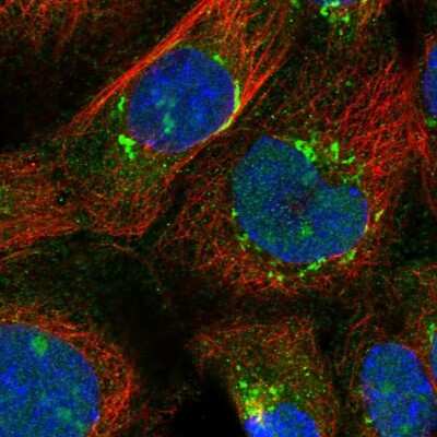 CRYL1 Antibody (NBP1-93718): Novus Biologicals