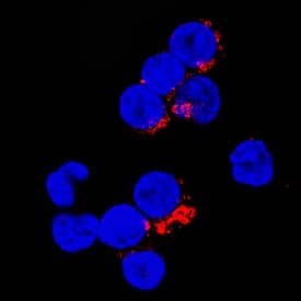 CTLA-4 was detected in immersion fixed human peripheral blood mononuclear cells (PBMCs) stimulated with PHA using Rabbit Anti-Human CTLA-4 Monoclonal Antibody (Catalog # MAB3253) at 8 µg/mL for 3 hours at room temperature. Cells were stained using the NorthernLights™ 557-conjugated Anti-Rabbit IgG Secondary Antibody (red; Catalog # NL004) and counterstained with DAPI (blue). Specific staining was localized to cytoplasm. View our protocol for Fluorescent ICC Staining of Non-adherent Cells.