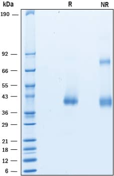 2 μg/lane of Recombinant Mouse CTRP9/C1qTNF9 was resolved with SDS-PAGE underreducing (R) and non-reducing (NR) conditions and visualized by Coomassie® Bluestaining, showing bands at 39-43 kDa and 39-43 & 80-90 kDa, respectively.