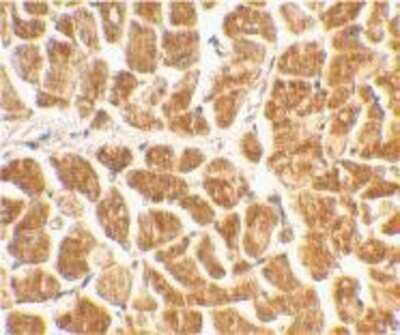 Immunohistochemistry-Paraffin: CX3CR1 Antibody [NBP1-76949] - Human heart tissue using CX3CR1 antibody at 2 ug/ml.