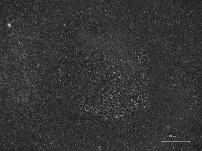 Immunohistochemistry-Paraffin: CX3CR1 Antibody [NBP1-76949] - Human tonsil, pH9 antigen retrieval.  Image from verified customer review. 